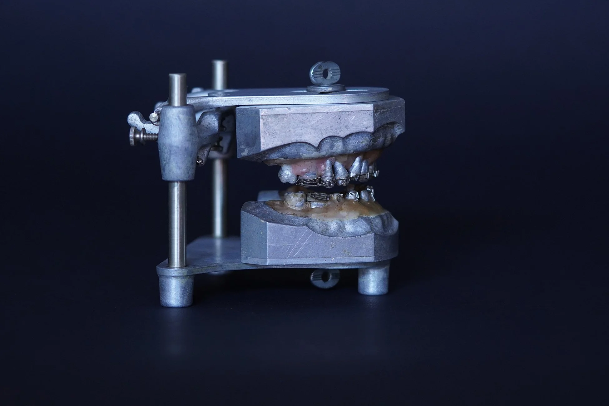 Shika×TOKYOGUNS CICAGO 1940's Orthodontic Teeth Set on Articulator Stand — AGENT GALLERY